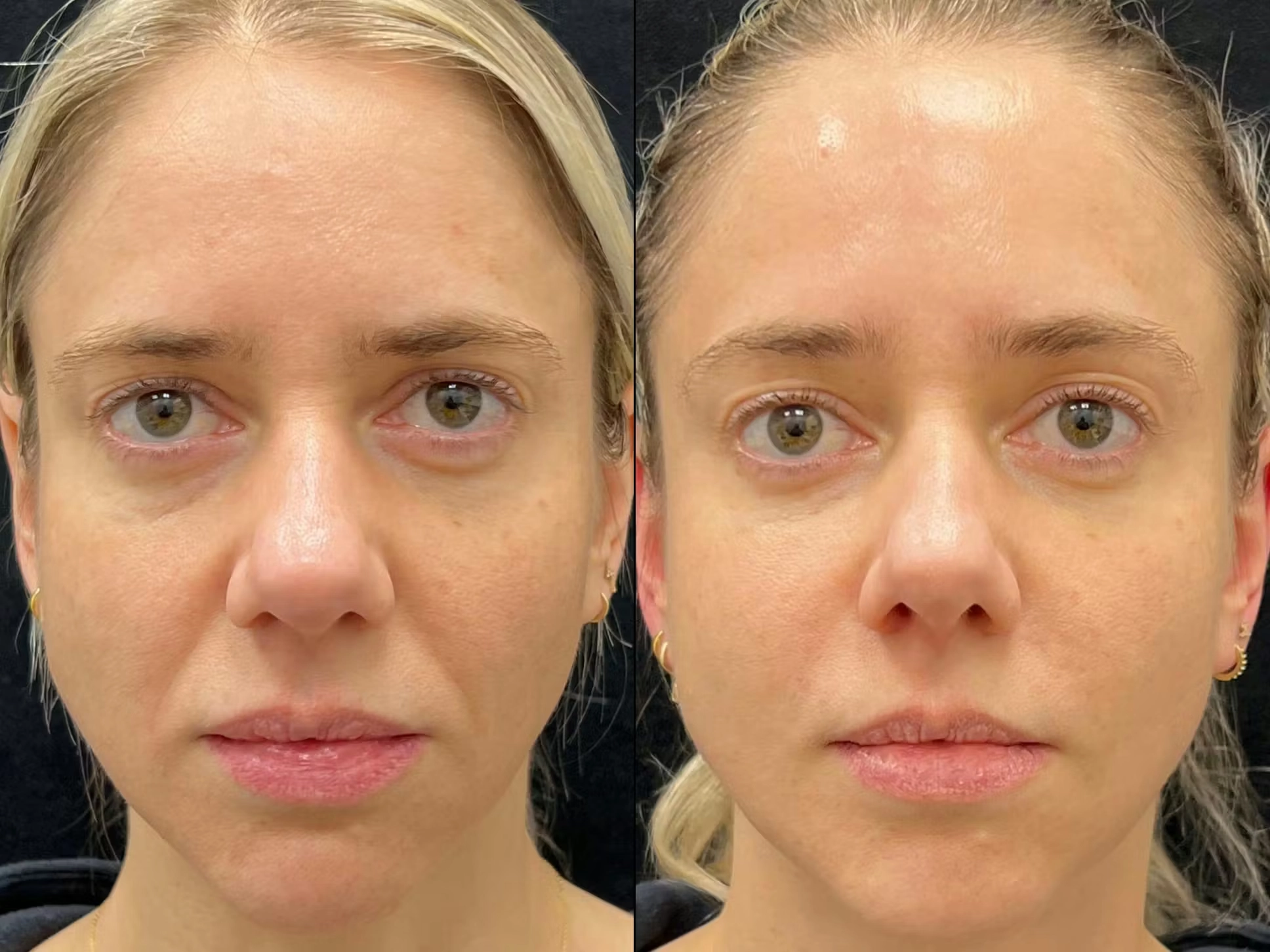 Balanced Facial Harmony