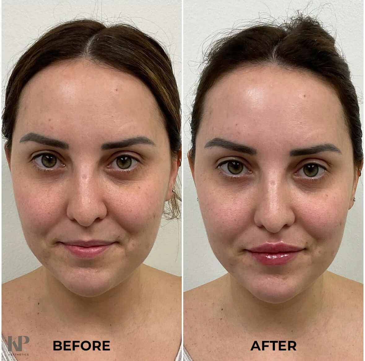 Subtle Volume Enhancement
