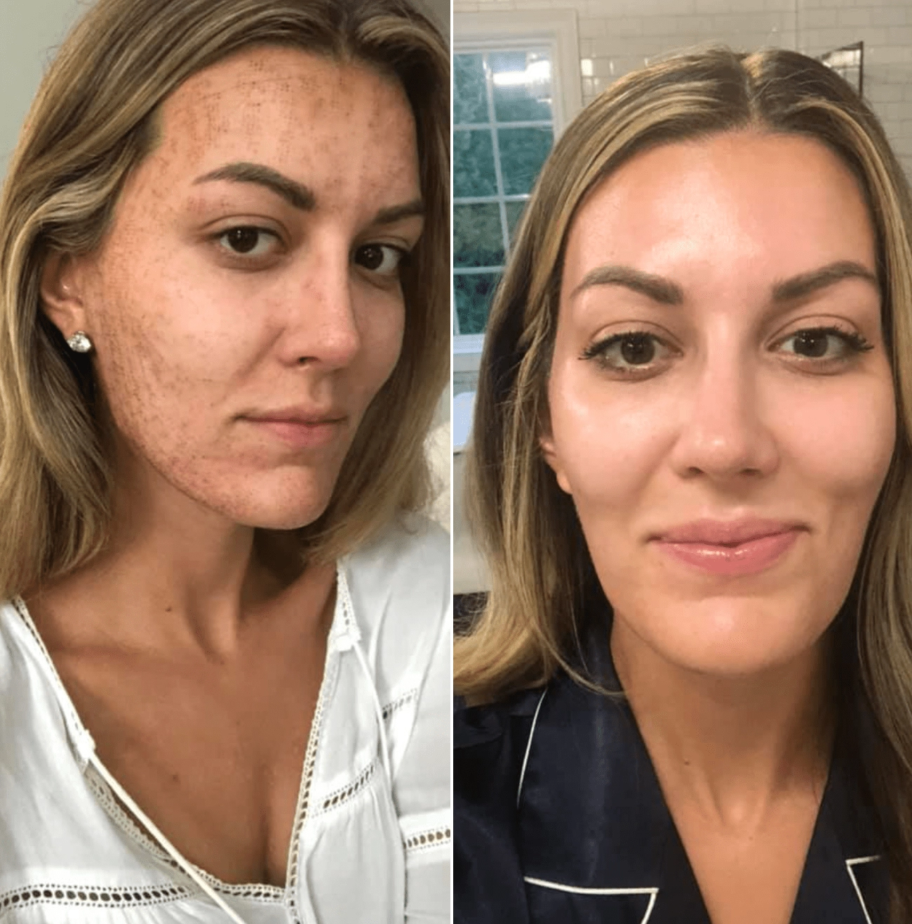 Clearer, Healthier Skin