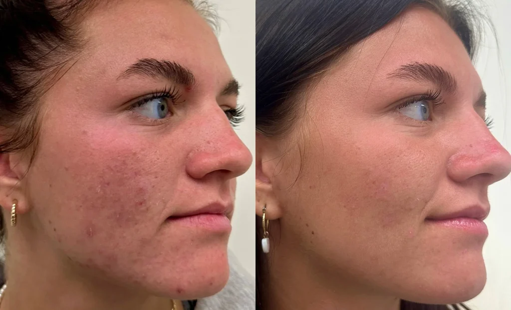 Skin Texture Renewal